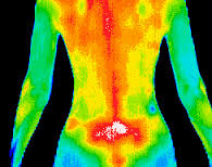 Thermography Ft. Lauderdale Florida